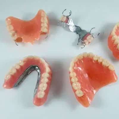 Rehabilitación Oral en Tacna 3 protesis removible tacna