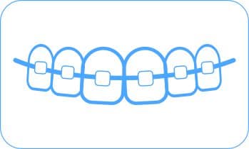 brackets esteticos icono