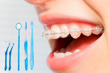 Brackets de Resina 5 higiene bucal con brackets de resina