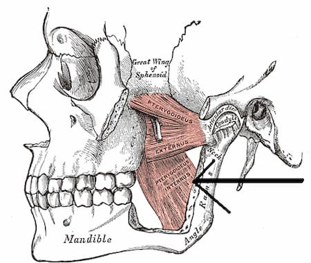 Implantes Dentales Pterigoideos 4 que es el pterigoideo