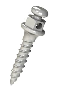 Ortodoncia con Mini implantes 2 minitornillos de ortodoncia