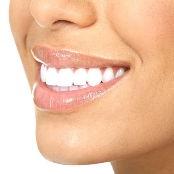 ¿Cómo se cura la gingivitis? 3 ¿Cómo se cura la gingivitis? 2